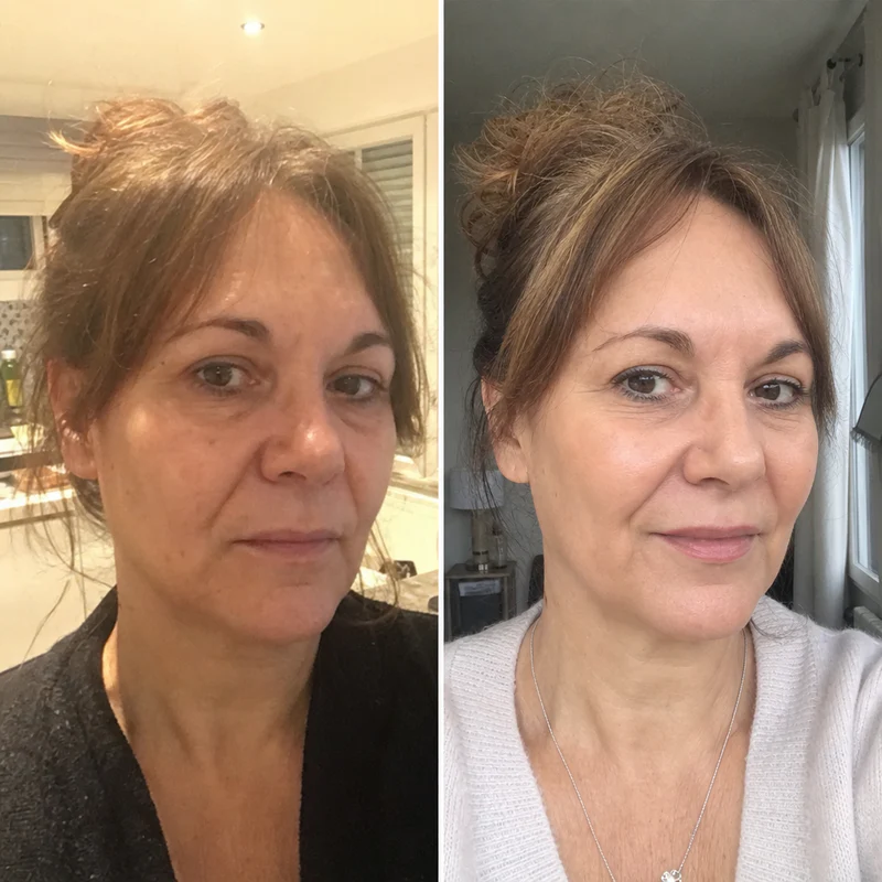 Résultat CleadOr - Action Anti-âge